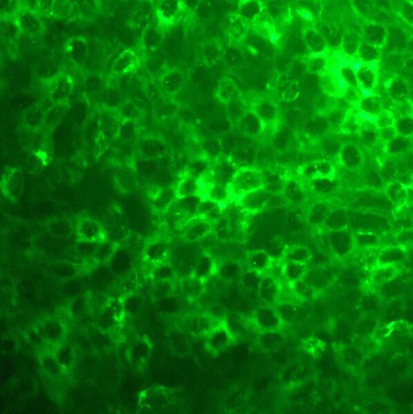 IF of A-431 GFP cells labeled with DSHB antibody DSHB-GEP-12A6 against green fluorescent protein (GFP). Image credit: Soll Laboratory, University of Iowa. 
